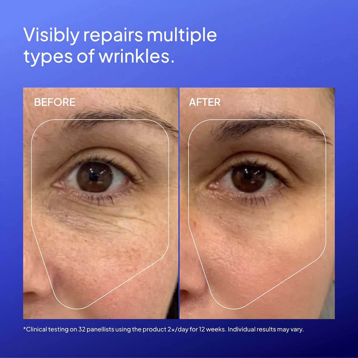 GHK-Cu Topical Serum