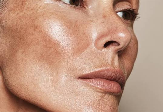 SIGNS OF AGING